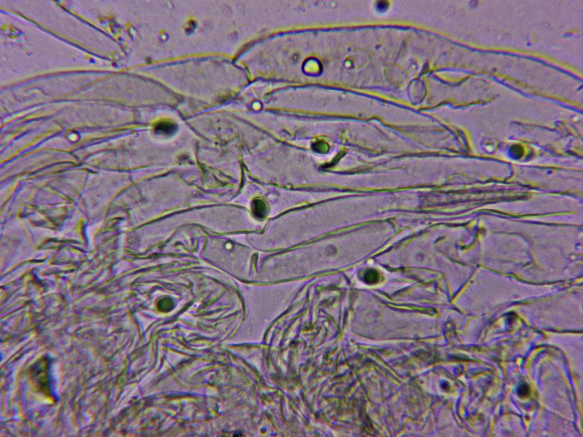 Microscopía de Tricholoma saponaceum - 10 - Hifas cutícula